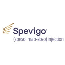 Spevigo