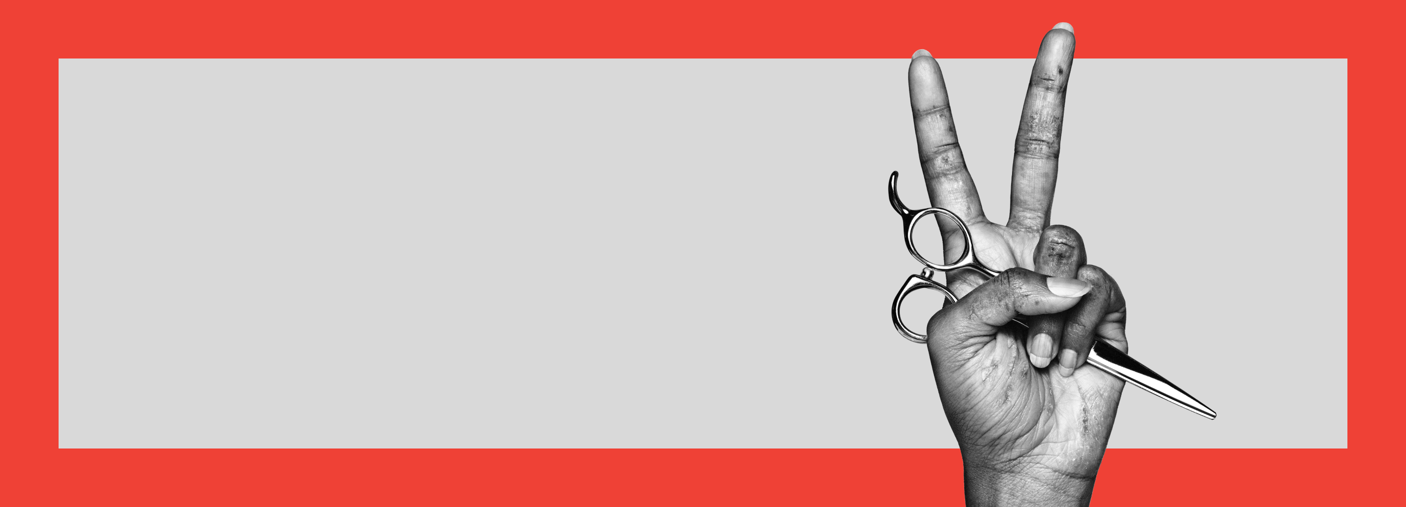 Zwart-witfoto van een hand met matig tot ernstig handeczeem die het 'peace' teken maakt en een kapperschaar vasthoudt.