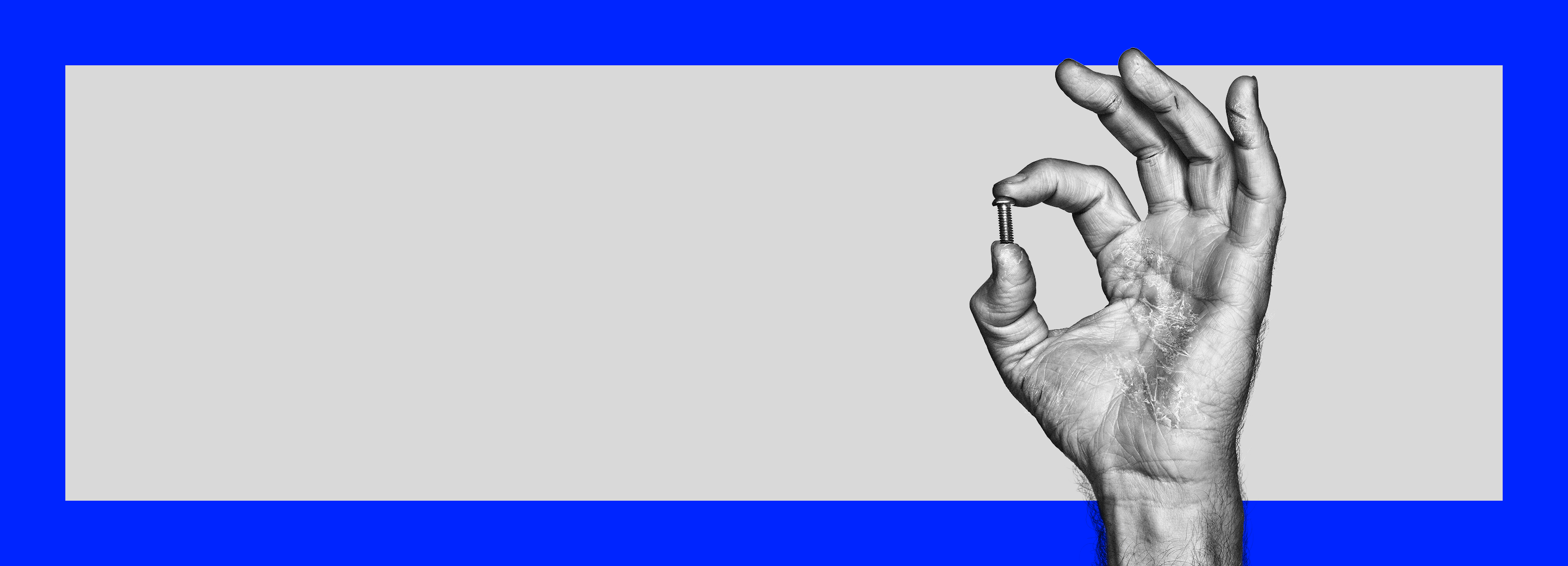 Black and white photograph of a hand with moderate to severe hand eczema making an 'okay' gesture while holding a mushroom head screw between forefinger and thumb.