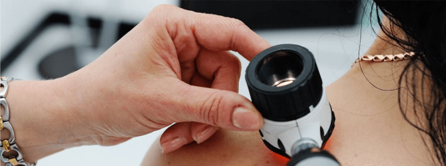 How is acne diagnosed? | Dermaworld