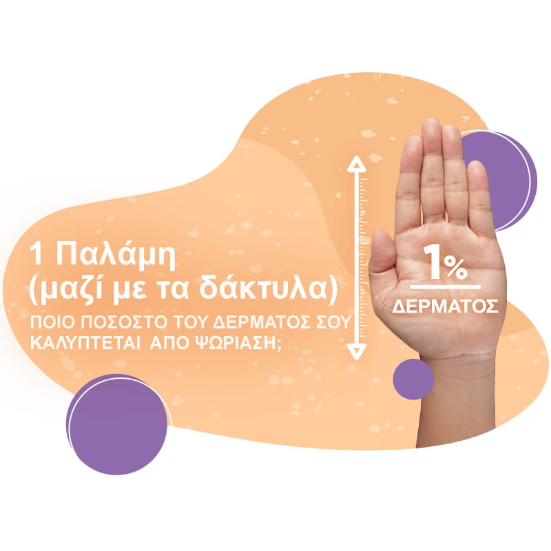 Έκταση ψωρίασης στο δέρμα