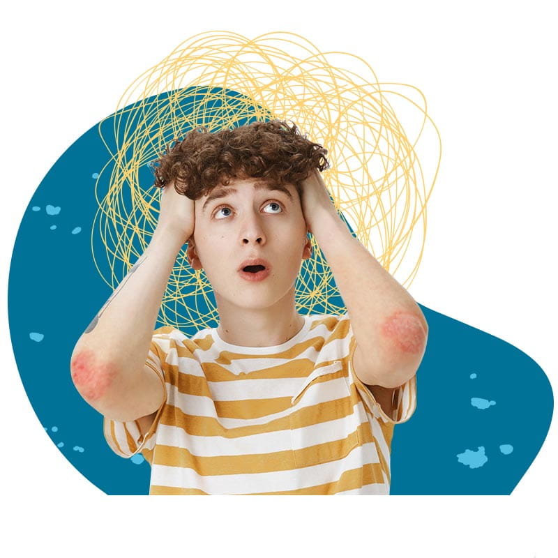 Ψωρίαση πόσο με επηρεάζει στην ψυχολογία μου