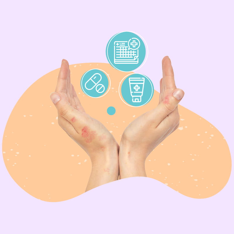 Θεραπείες για μέτρια-σοβαρή ψωρίαση