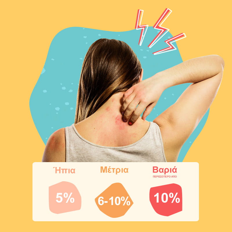 Βαρύτητα ψωρίασης