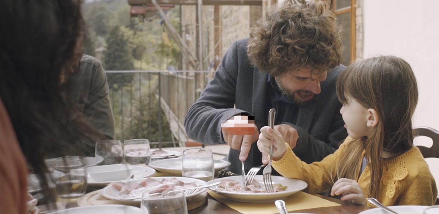 Μην αφήνεις την ψωρίαση να σε περιορίζει