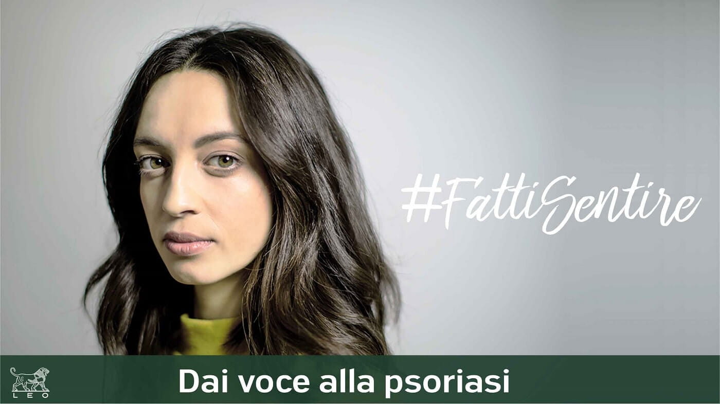 Parlare della psoriasi