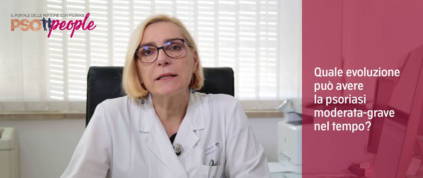 anteprima psoriasi moderata-grave