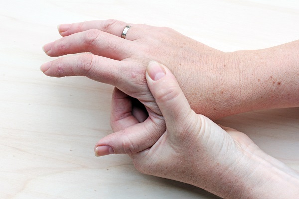Psoriatic arthritis hands