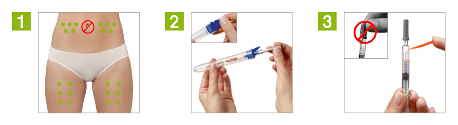 Anleitung zur Injektion einer Thrombose-Spritze 