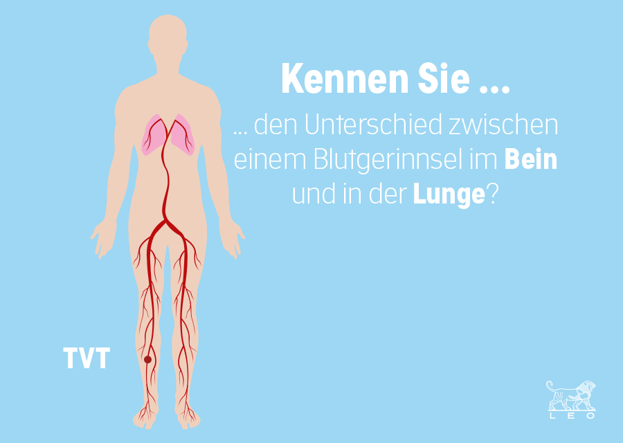 Animation zur Entstehung einer Lungenembolie 