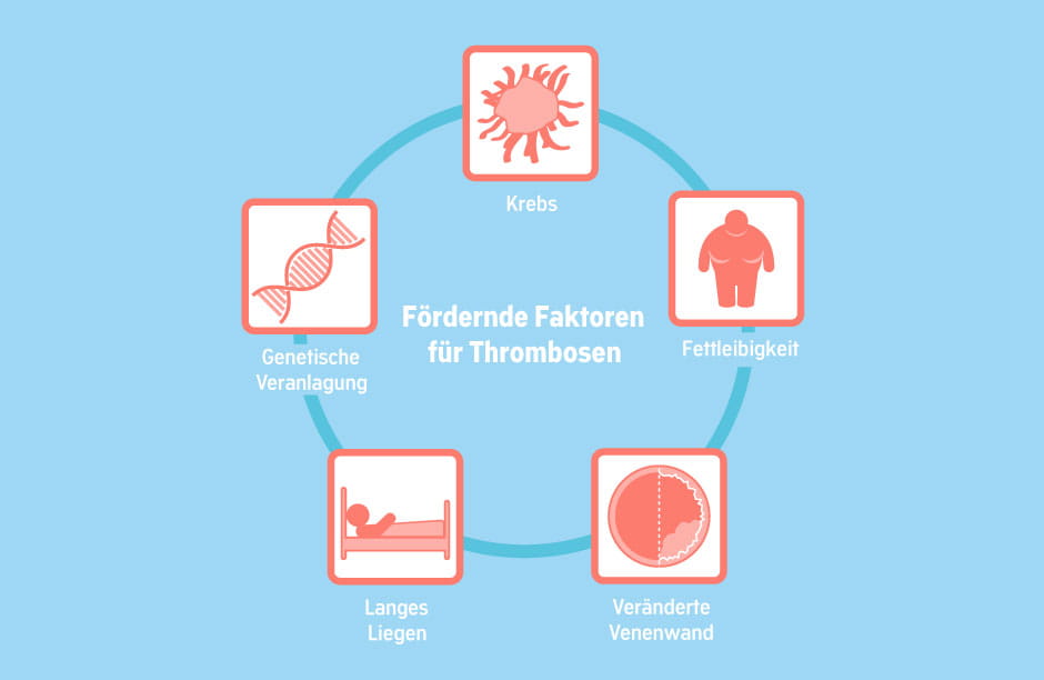 Schema zu Thrombose begünstigenden Faktoren