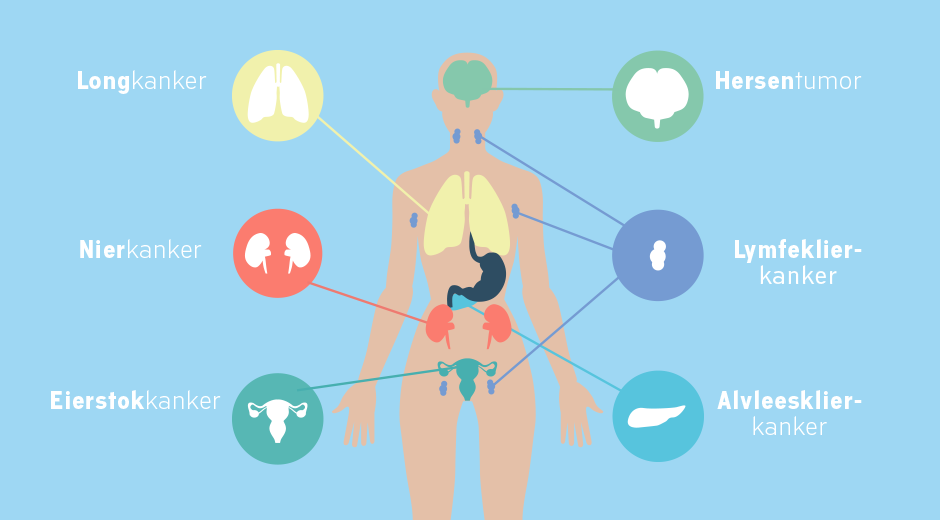 CancerClot™ | Verband Tussen Kanker En DVT | CancerClot™