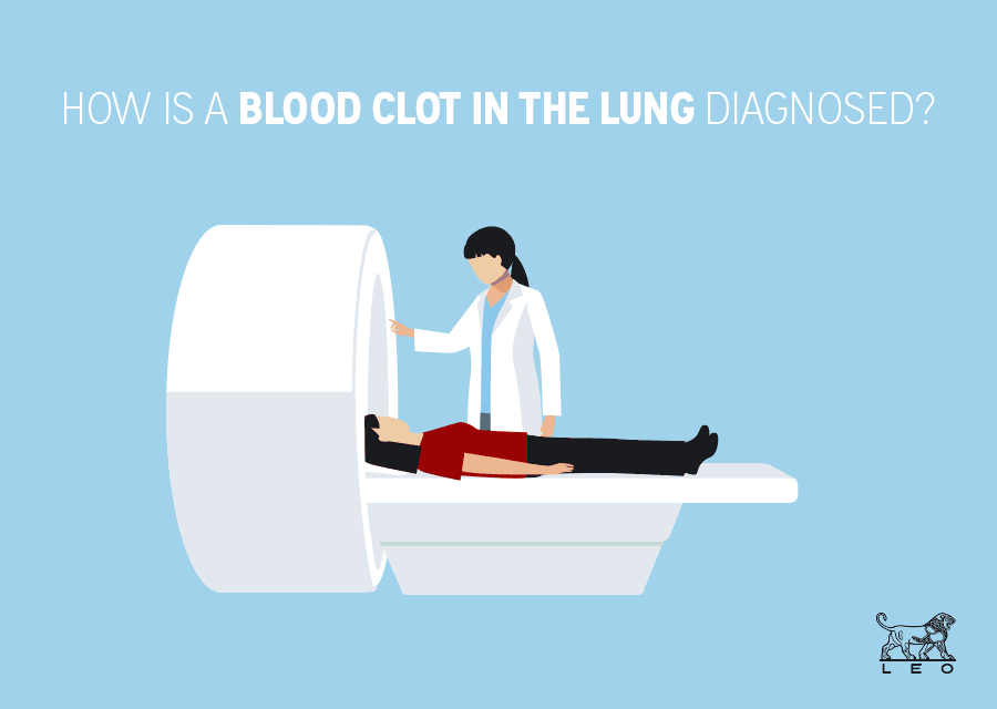 How are DVT and PE diagnosed? CancerClot™
