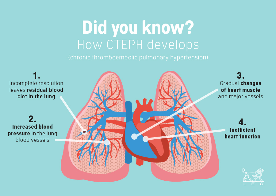 CTEPH