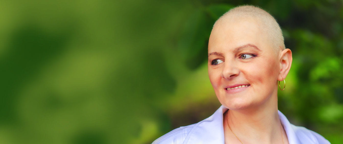Woman with hair loss due to cancer