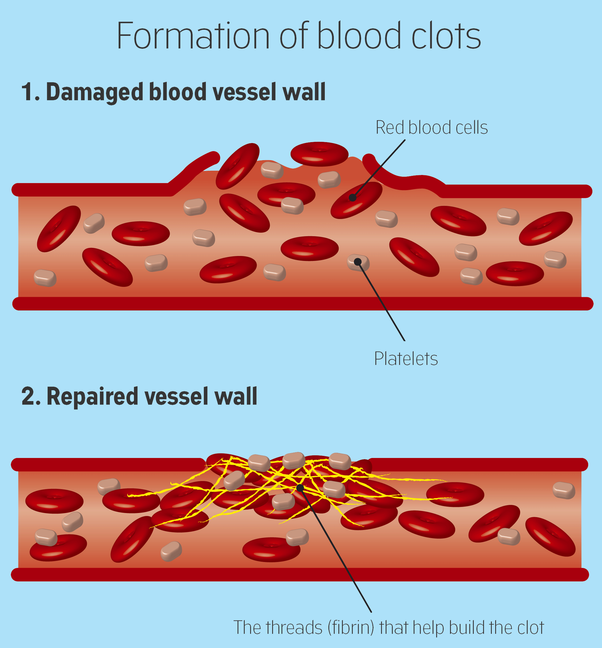 How Blood Clots Go From Good To Bad | CancerClot™