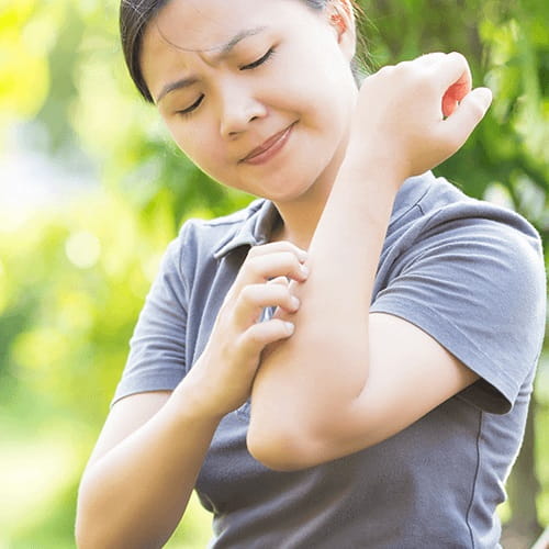 Scratching elbow eczema