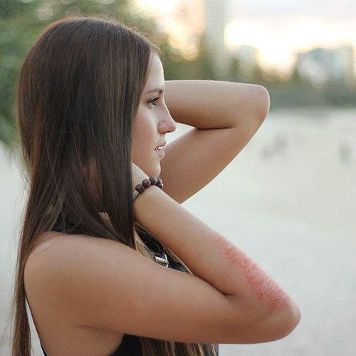 Woman thinking about her eczema