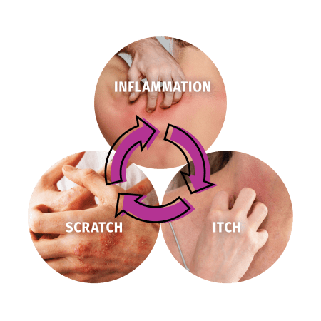 Graphic showing the cycle of inflammation, scratch, and itch related to eczema.