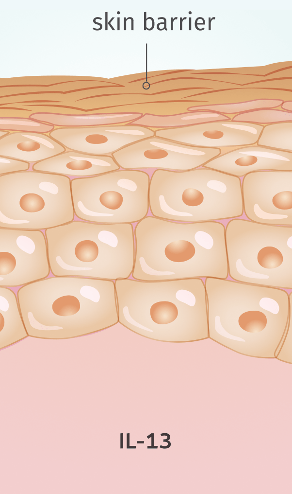 Normal skin with the skin barrier intact, IL-13 shown.