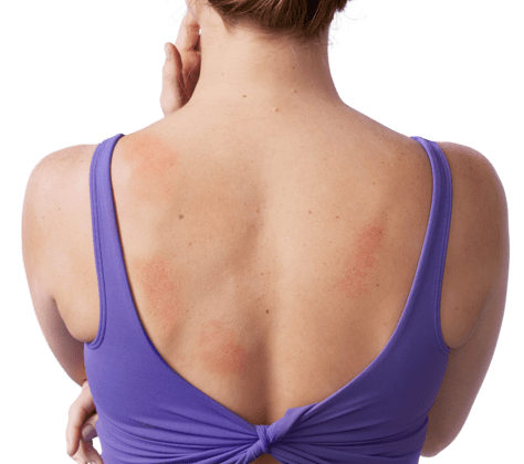 Image of woman’s back
