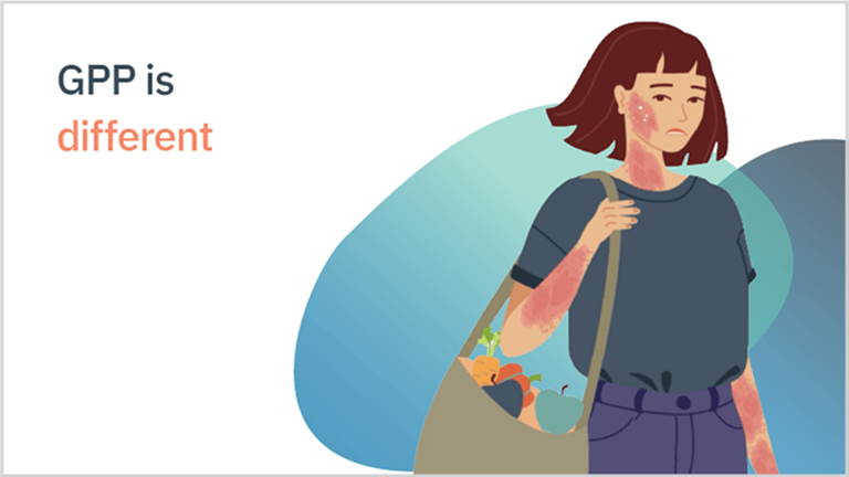Video thumbnail showing a woman with GPP and the text "GPP is different"