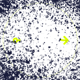 Illustration of a tangled line symbolizing anxiety, a common emotional impact of chronic hand eczema.