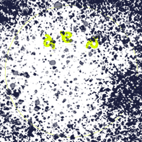 Icon of a person holding their head with symbols of distress, representing the feeling of embarrassment caused by chronic hand eczema.